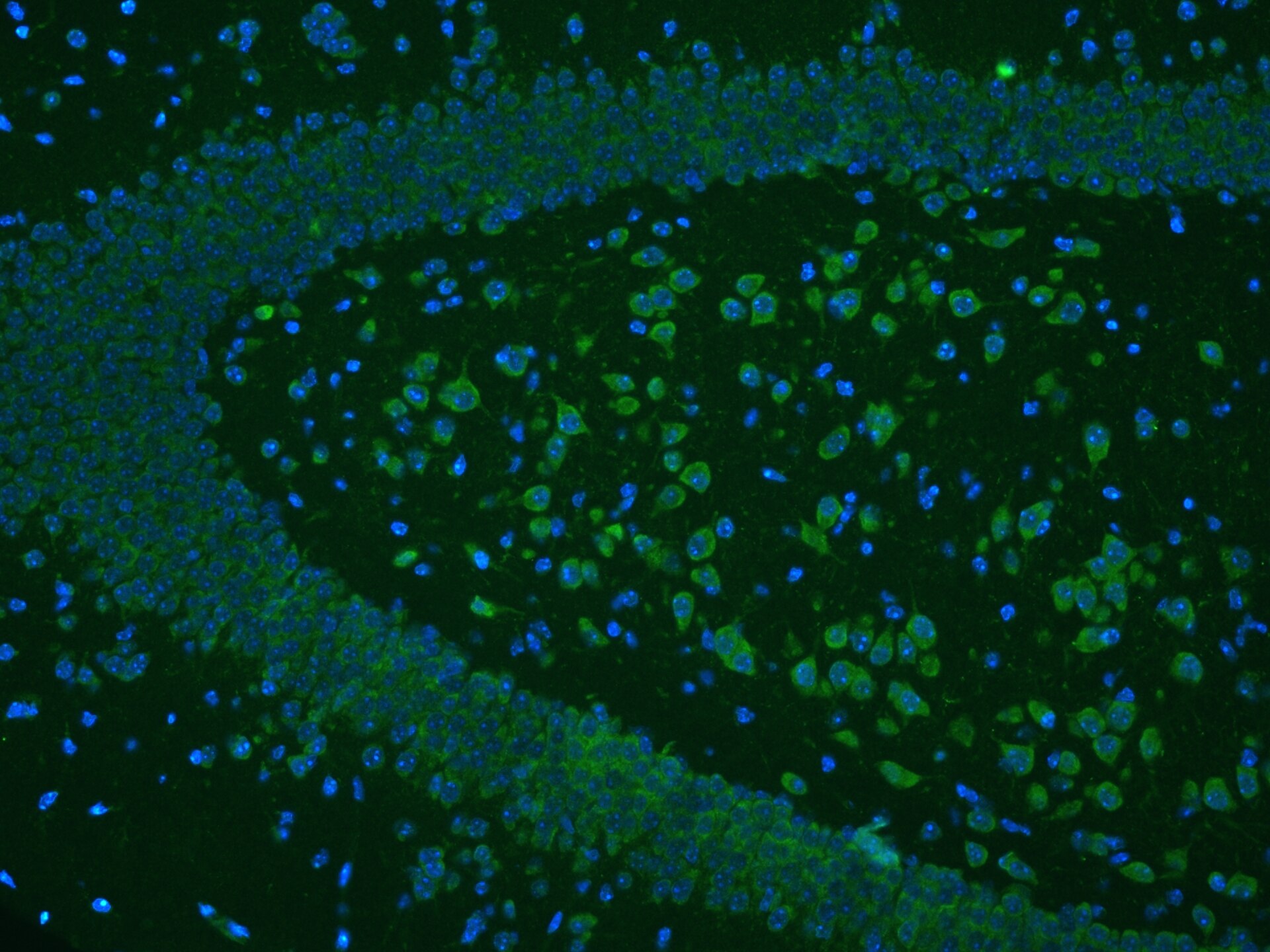 IF Staining of mouse brain using 13038-1-AP