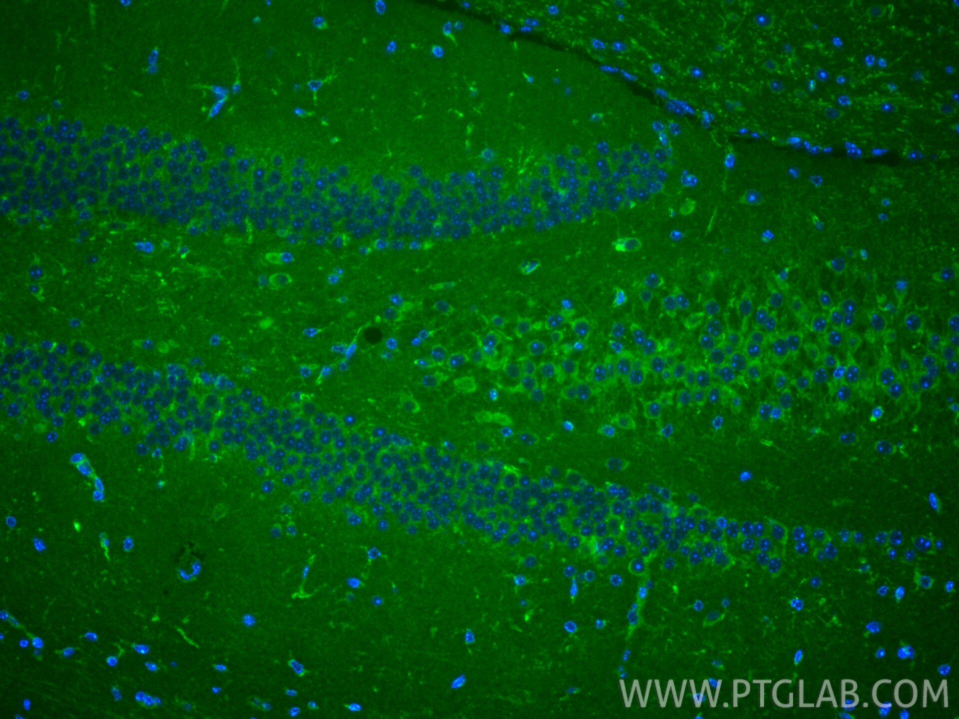 IF Staining of mouse brain using 13038-1-AP Immunofluorescence (IF) / fluorescent staining of mouse brain tissue using FMNL2 Polyclonal antibody (13038-1-AP)
