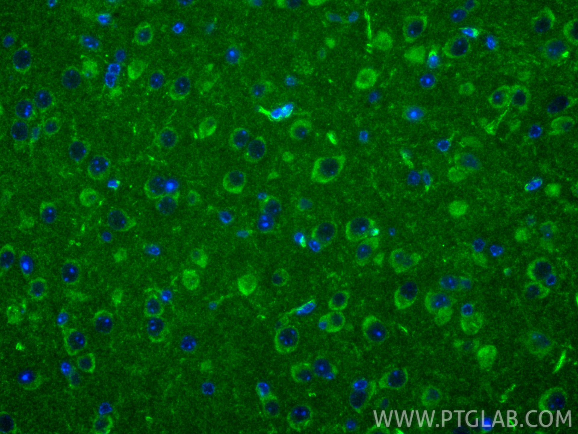 IF Staining of mouse brain using 13038-1-AP Immunofluorescence (IF) / fluorescent staining of mouse brain tissue using FMNL2 Polyclonal antibody (13038-1-AP)
