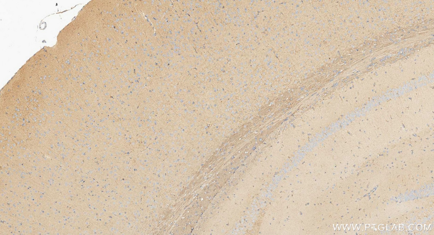 IHC staining of mouse brain using 13038-1-AP Immunohistochemistry (IHC) staining of mouse brain tissue using FMNL2 Polyclonal antibody (13038-1-AP)