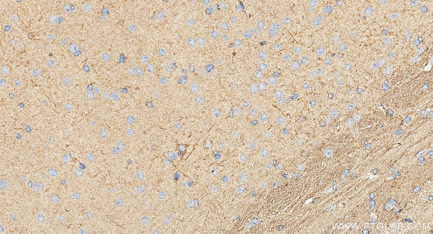 IHC staining of mouse brain using 13038-1-AP Immunohistochemistry (IHC) staining of mouse brain tissue using FMNL2 Polyclonal antibody (13038-1-AP)