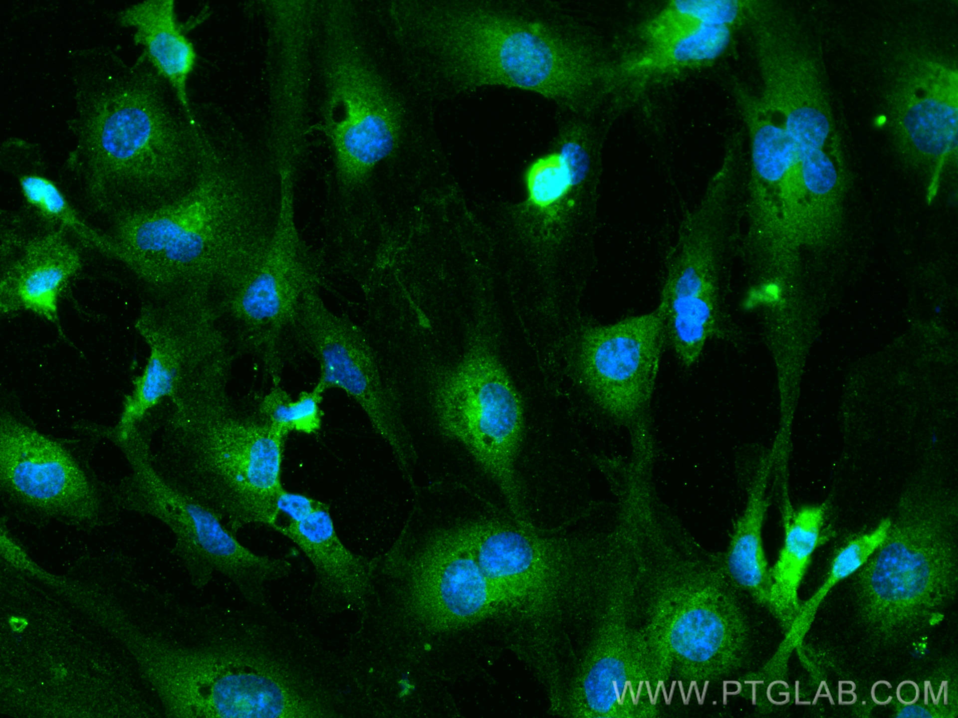 Immunofluorescence (IF) / fluorescent staining of HUVEC cells using FMNL3 Polyclonal antibody (29756-1-AP)