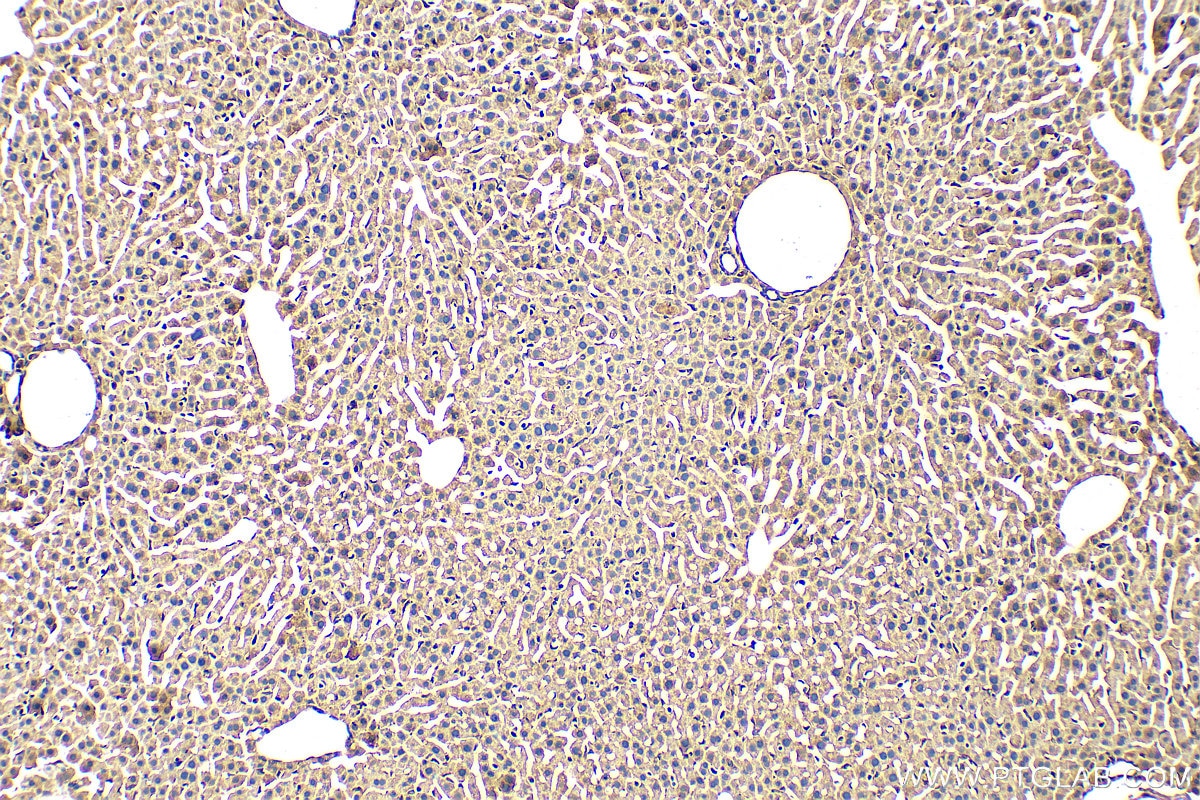 Immunohistochemistry (IHC) staining of mouse liver tissue using FMNL3 Polyclonal antibody (29756-1-AP)