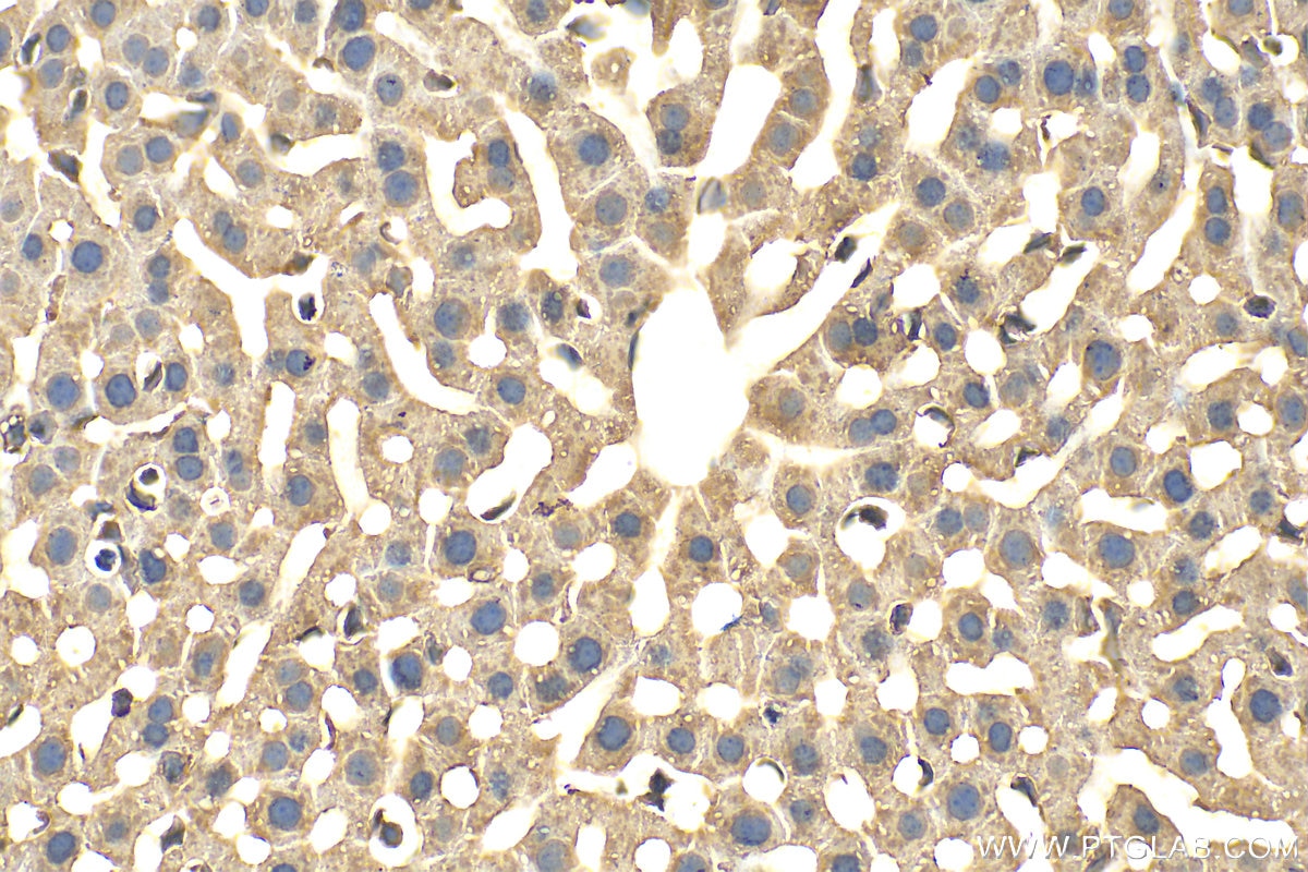 Immunohistochemistry (IHC) staining of mouse liver tissue using FMNL3 Polyclonal antibody (29756-1-AP)