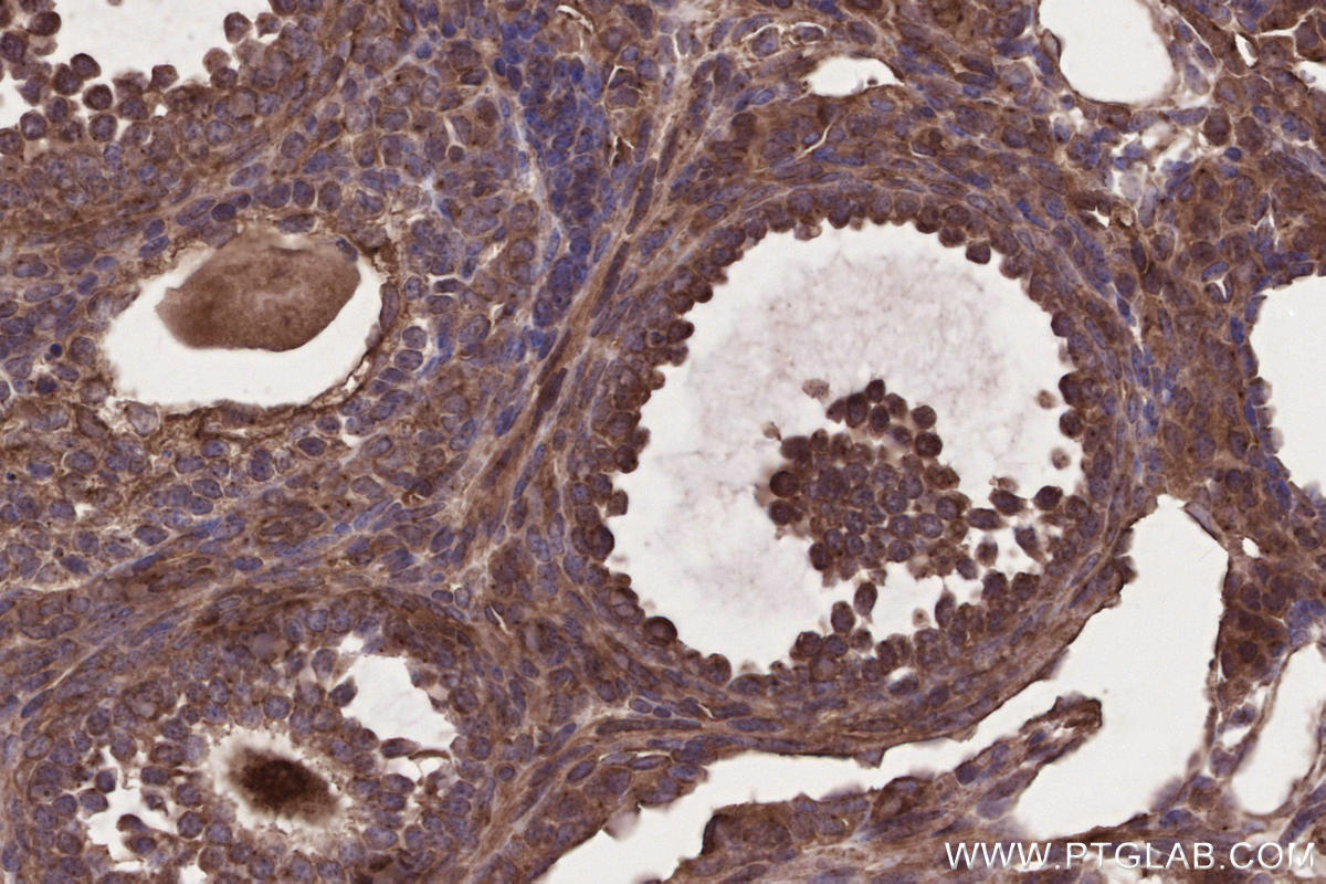 IHC staining of mouse ovary using 29756-1-AP Immunohistochemistry (IHC) staining of mouse ovary tissue using FMNL3 Polyclonal antibody (29756-1-AP)