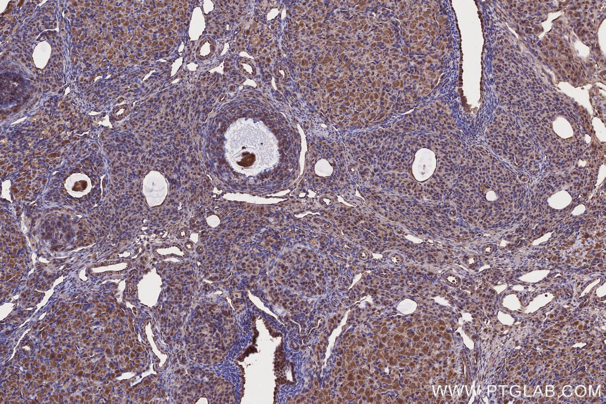 IHC staining of rat ovary using 29756-1-AP Immunohistochemistry (IHC) staining of rat ovary tissue using FMNL3 Polyclonal antibody (29756-1-AP)