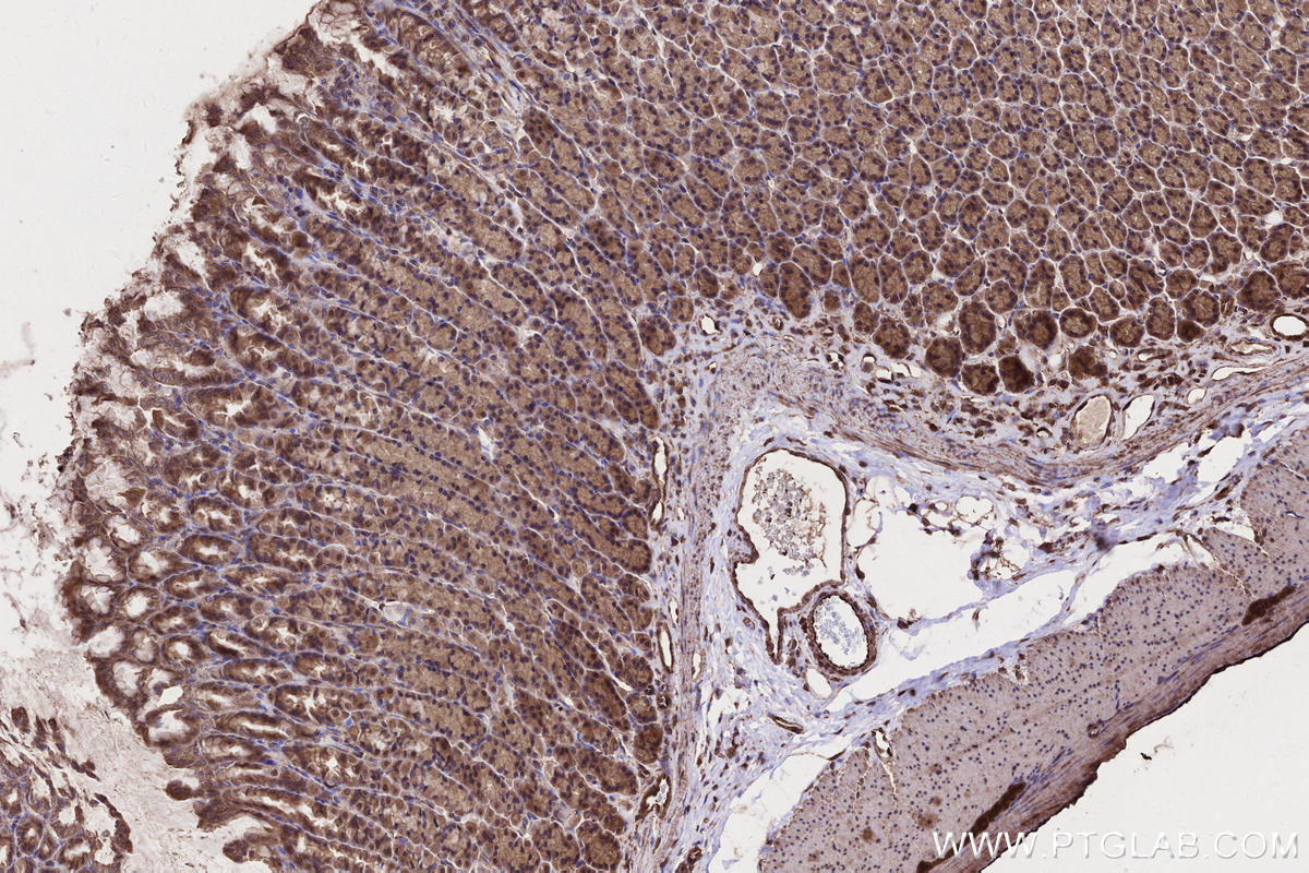 IHC staining of rat stomach using 29756-1-AP Immunohistochemistry (IHC) staining of rat stomach tissue using FMNL3 Polyclonal antibody (29756-1-AP)