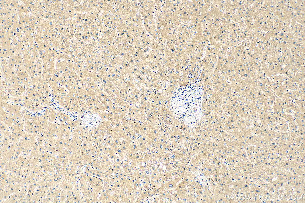 Immunohistochemistry (IHC) staining of human liver tissue using FMO1 Polyclonal antibody (30977-1-AP)