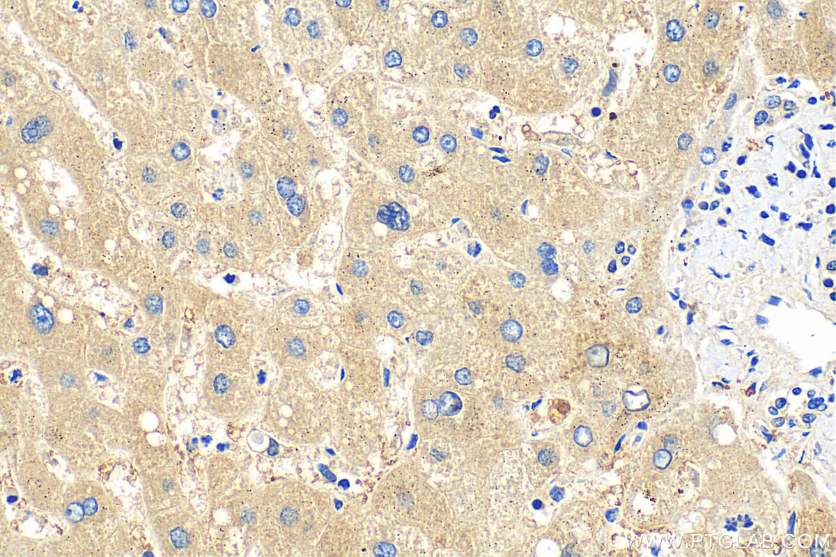 Immunohistochemistry (IHC) staining of human liver tissue using FMO1 Polyclonal antibody (30977-1-AP)