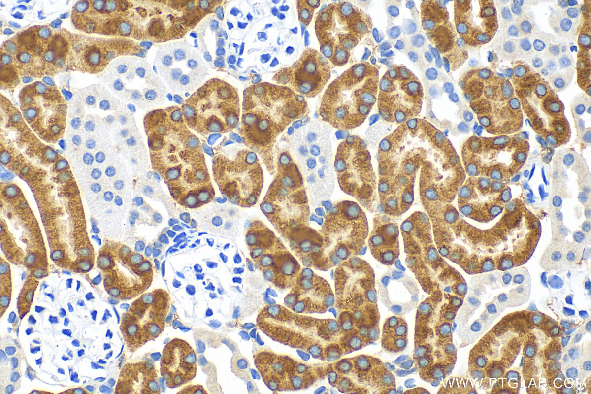 Immunohistochemistry (IHC) staining of mouse kidney tissue using FMO1 Polyclonal antibody (30977-1-AP)