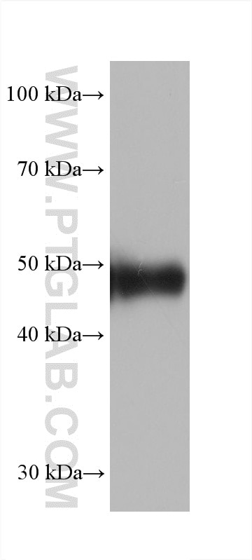 pig kidney tissue were subjected to SDS PAGE followed by western blot with 61032-3-Ig (FMO1 antibody) at dilution of 1:20000 incubated at room temperature for 1.5 hours. Western Blot (WB) analysis of pig kidney tissue using FMO1 Monoclonal antibody (61032-3-Ig)