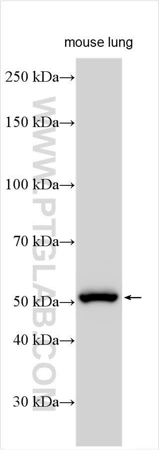 Western Blot (WB) analysis of various lysates using FMO2 Polyclonal antibody (15725-1-AP)