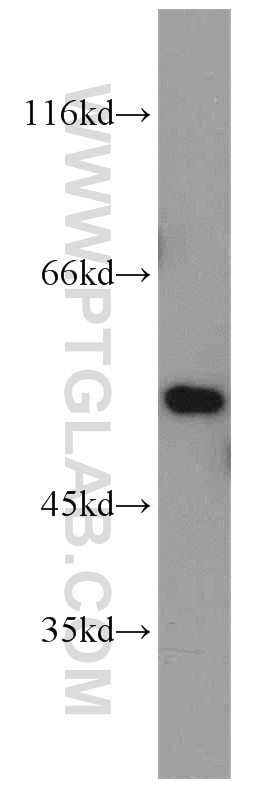 Western Blot (WB) analysis of mouse lung tissue using FMO2 Polyclonal antibody (15725-1-AP)