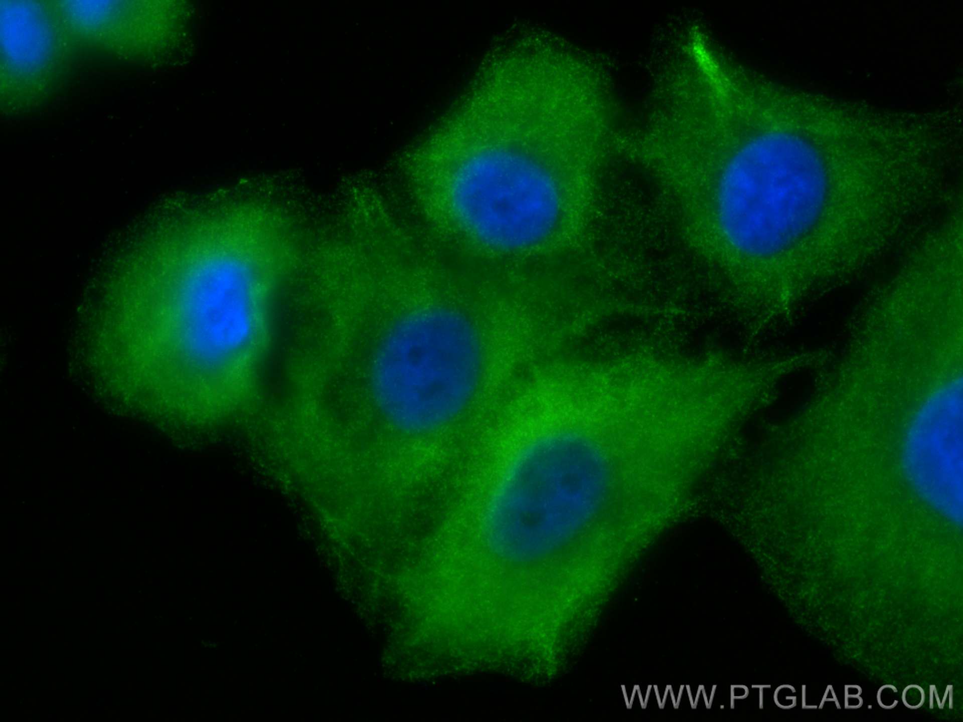 Immunofluorescence (IF) / fluorescent staining of A549 cells using FMO2 Monoclonal antibody (67019-1-Ig)