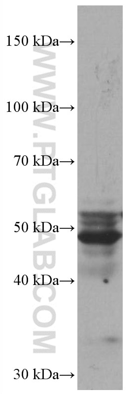 Western Blot (WB) analysis of A549 cells using FMO2 Monoclonal antibody (67019-1-Ig)