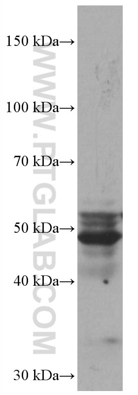 WB analysis of A549 using 67019-1-Ig