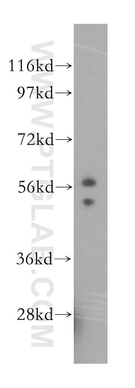 WB analysis of mouse lung using 16861-1-AP