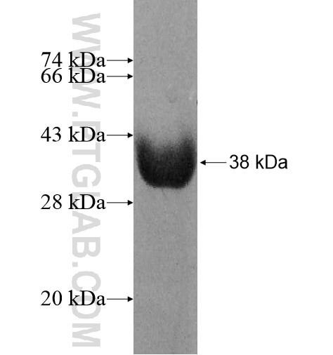 FMO3 fusion protein Ag11405 SDS-PAGE