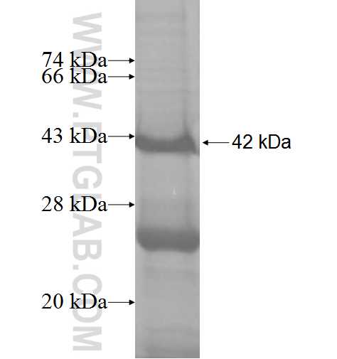 FMO4 fusion protein Ag7935 SDS-PAGE