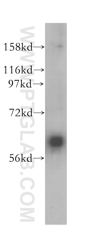 Western Blot (WB) analysis of mouse lung tissue using FMO5 Polyclonal antibody (13699-1-AP)