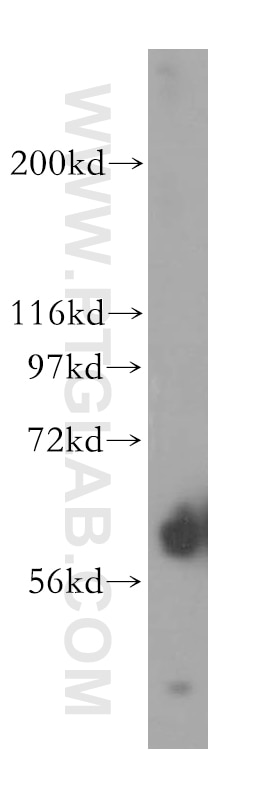 Western Blot (WB) analysis of human liver tissue using FMO5 Polyclonal antibody (13699-1-AP)