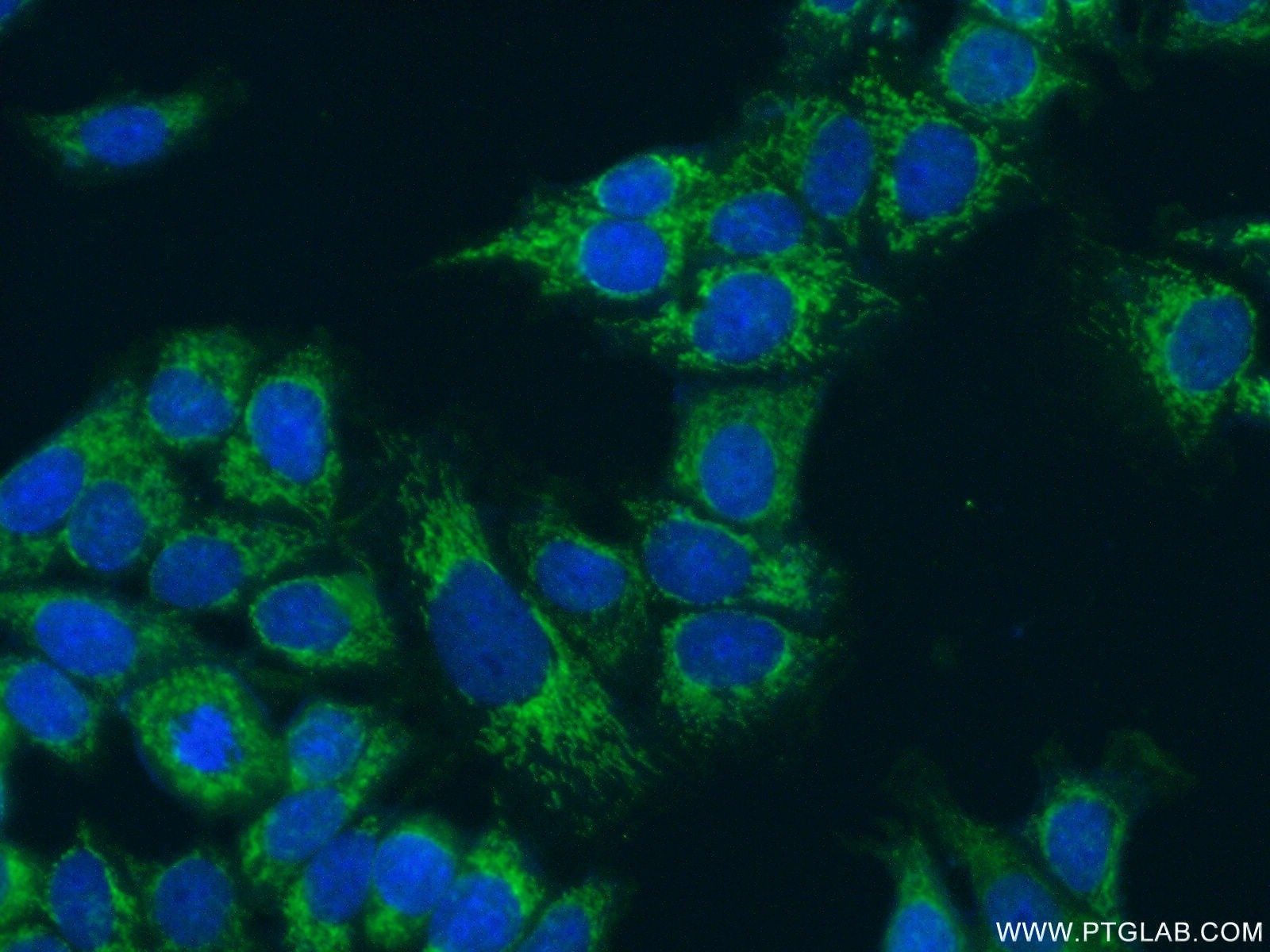 Immunofluorescence (IF) / fluorescent staining of MCF-7 cells using FMO5-specific Polyclonal antibody (16864-1-AP)