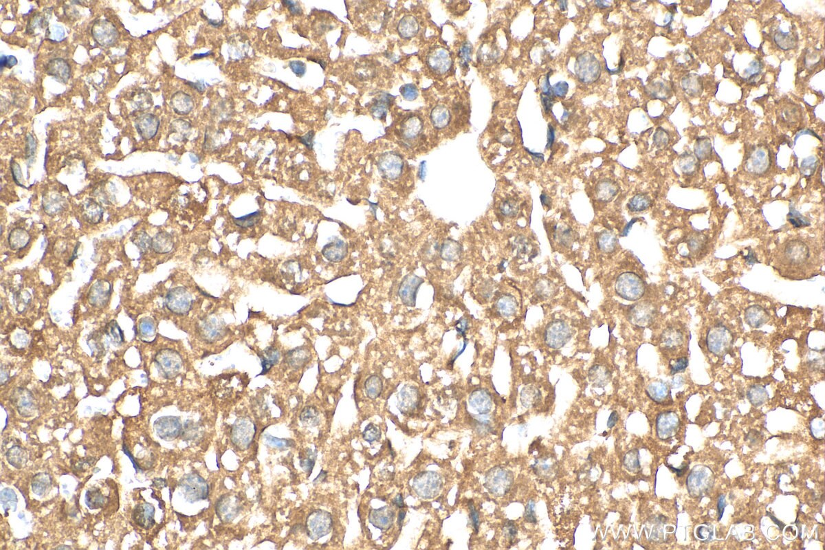 Immunohistochemistry (IHC) staining of mouse liver tissue using FMO5-specific Polyclonal antibody (16864-1-AP)