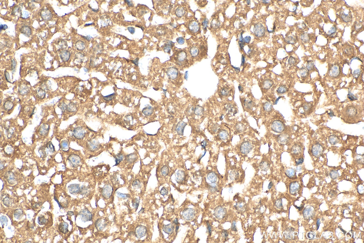 IHC staining of mouse liver using 16864-1-AP