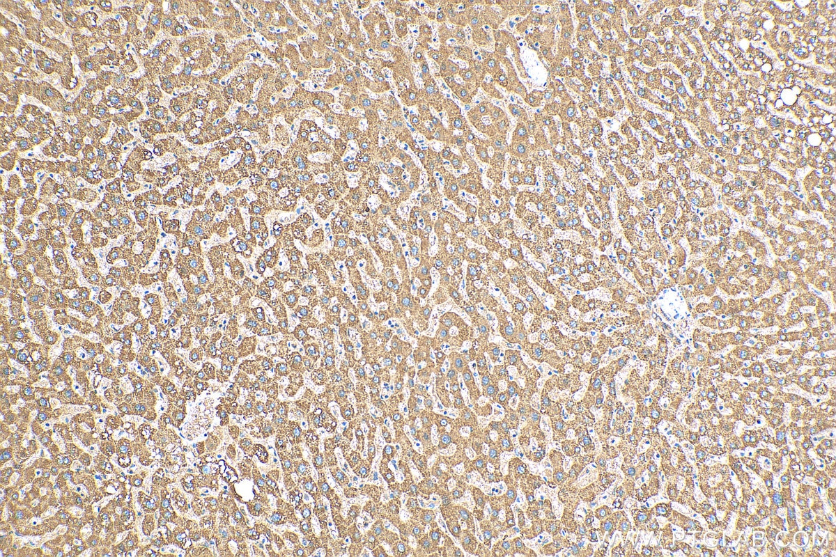 Immunohistochemistry (IHC) staining of human liver tissue using FMO5-specific Polyclonal antibody (16864-1-AP)