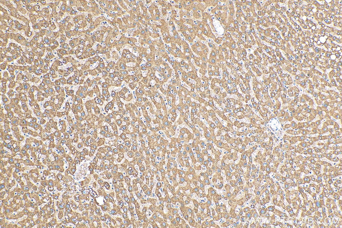 IHC staining of human liver using 16864-1-AP