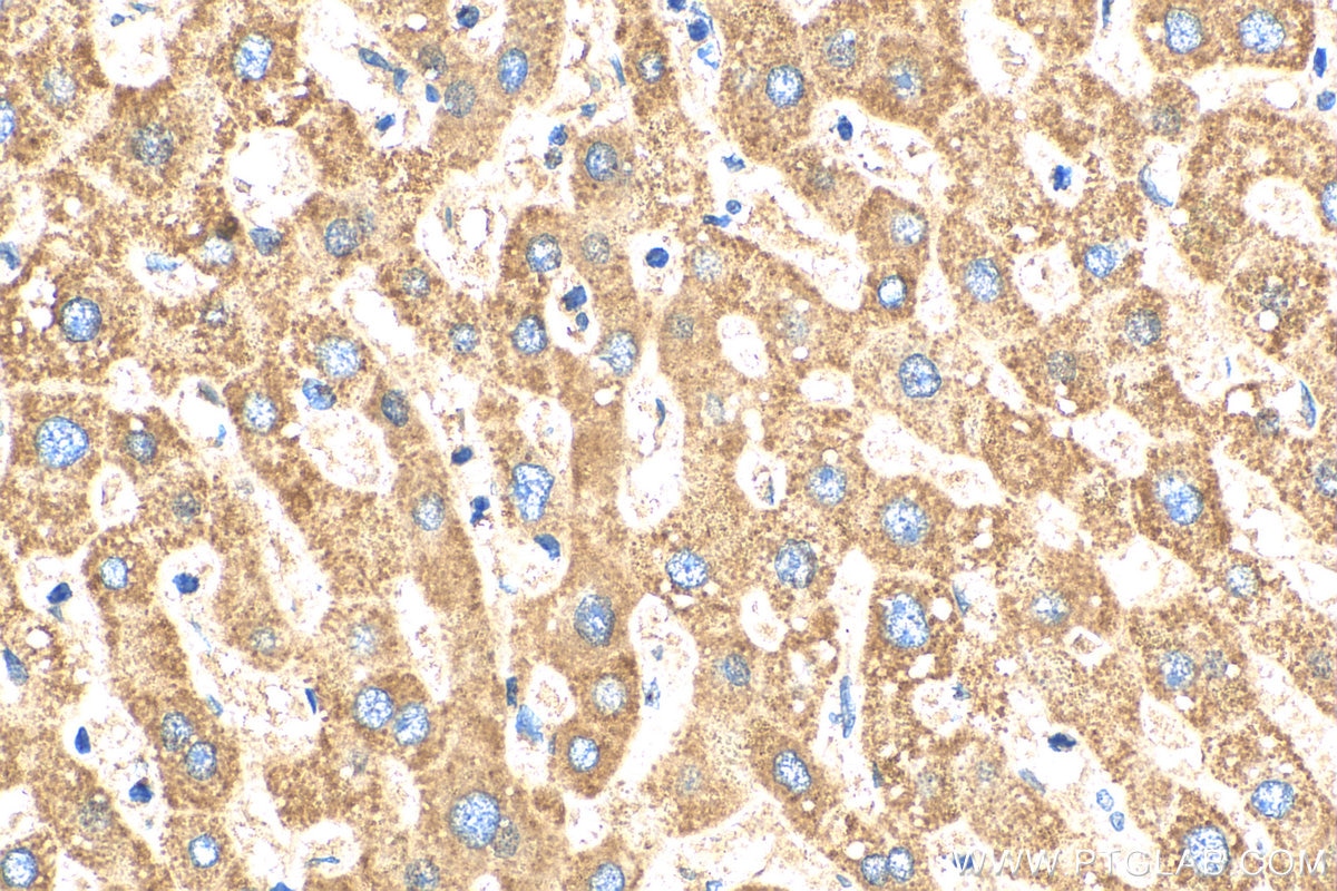 Immunohistochemistry (IHC) staining of human liver tissue using FMO5-specific Polyclonal antibody (16864-1-AP)