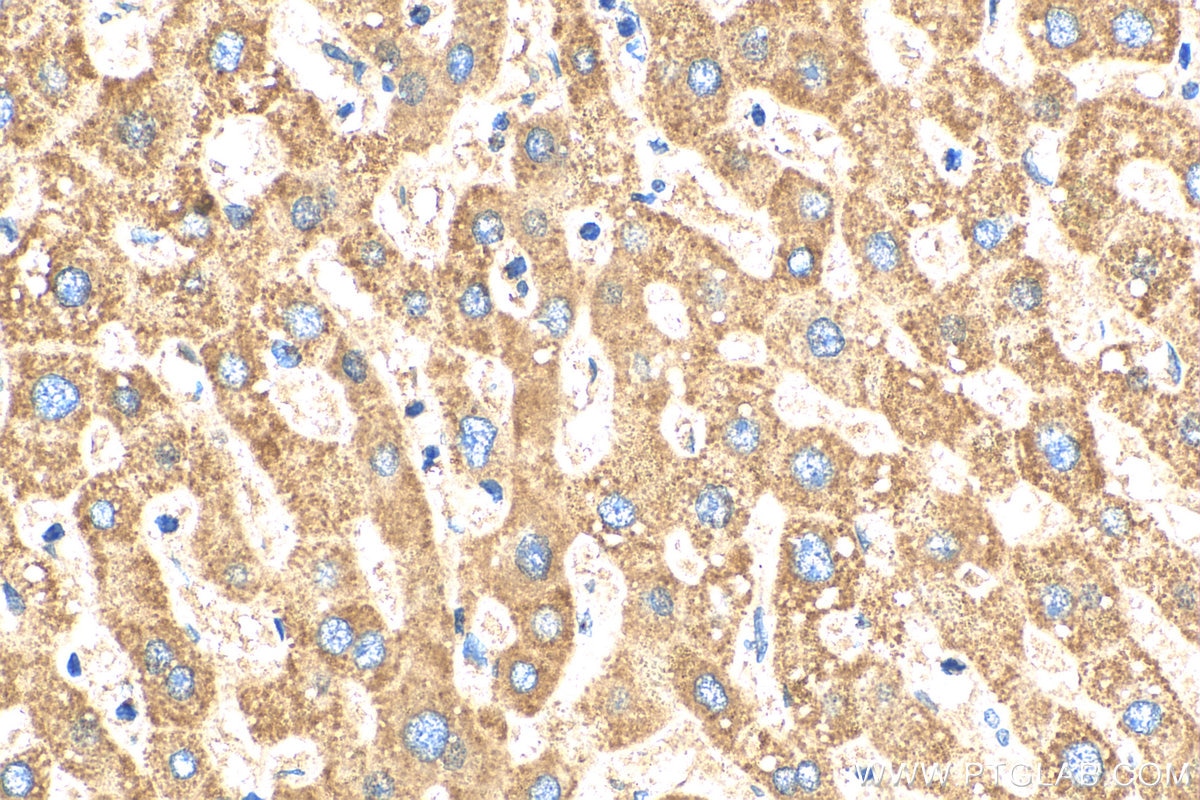 Immunohistochemistry (IHC) staining of human liver tissue using FMO5-specific Polyclonal antibody (16864-1-AP)