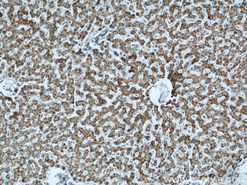 IHC staining of human liver using 16864-1-AP