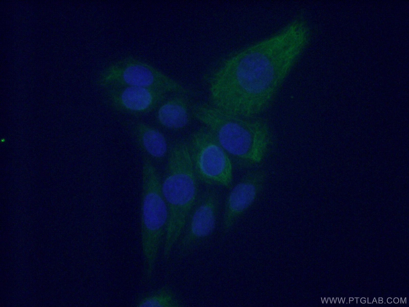 Immunofluorescence (IF) / fluorescent staining of HeLa cells using Fibromodulin Polyclonal antibody (13281-1-AP)