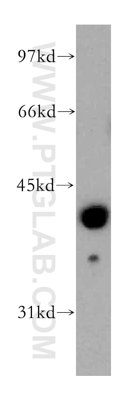 Western Blot (WB) analysis of human liver tissue using Fibromodulin Polyclonal antibody (13281-1-AP)