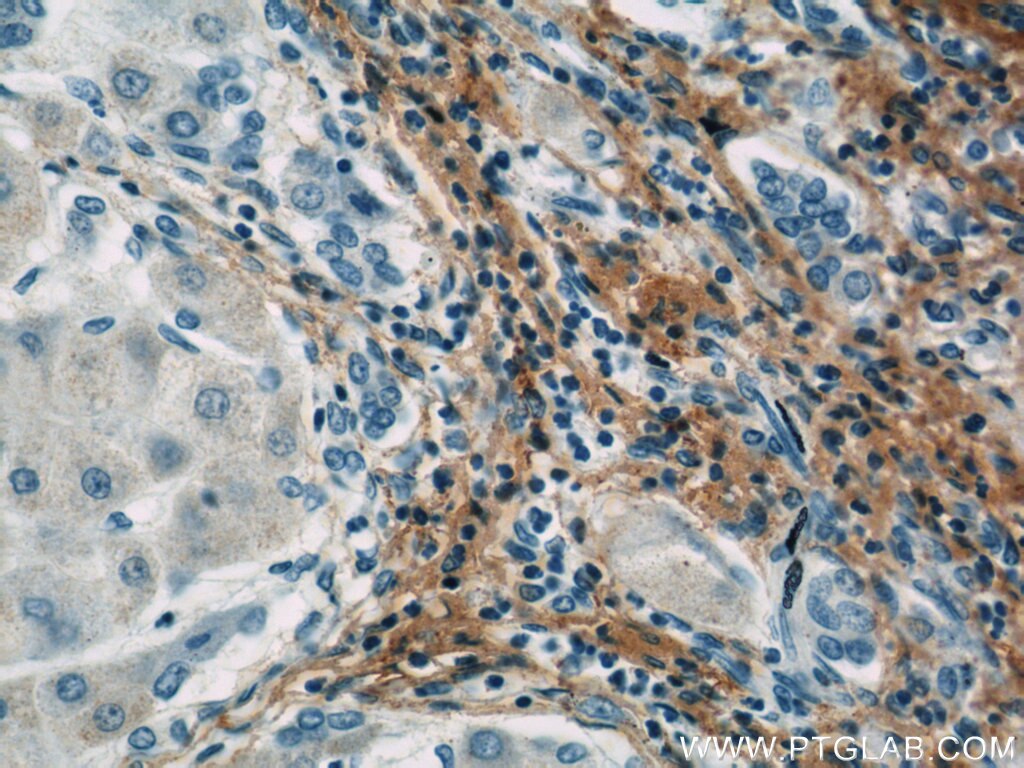Fibromodulin Monoclonal antibody