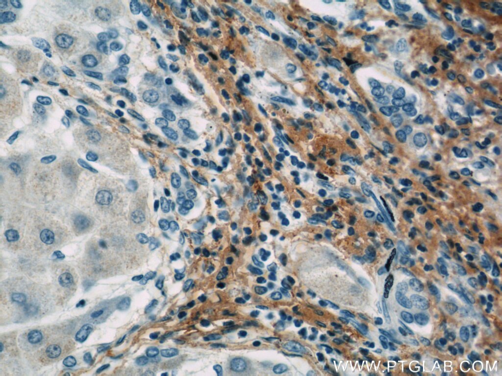 Fibromodulin Monoclonal antibody