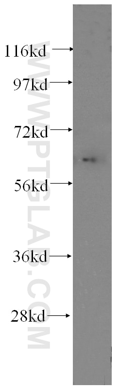 Western Blot (WB) analysis of human kidney tissue using Fibromodulin Monoclonal antibody (60108-1-Ig)