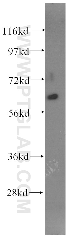 Western Blot (WB) analysis of human kidney tissue using Fibromodulin Monoclonal antibody (60108-1-Ig)