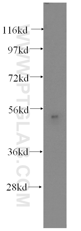 Western Blot (WB) analysis of human stomach tissue using Fibromodulin Monoclonal antibody (60108-1-Ig)