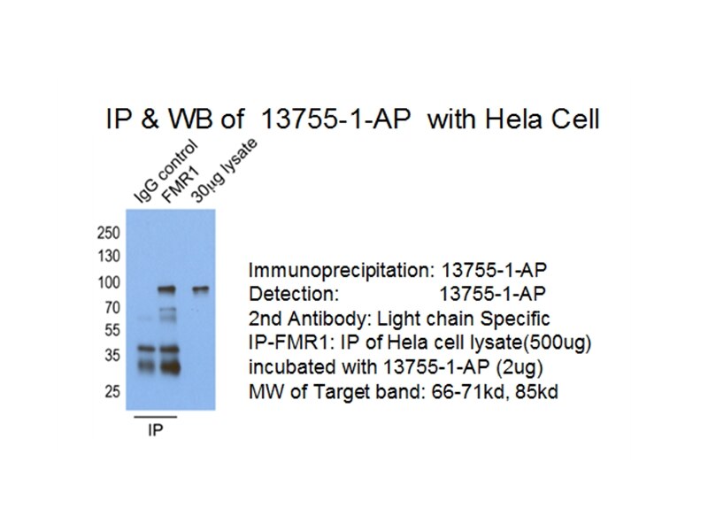 Immunoprecipitation (IP) experiment of HeLa cells using FMR1 Polyclonal antibody (13755-1-AP)