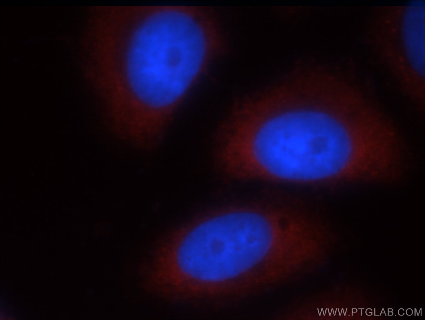 IF Staining of HepG2 using 13755-1-AP