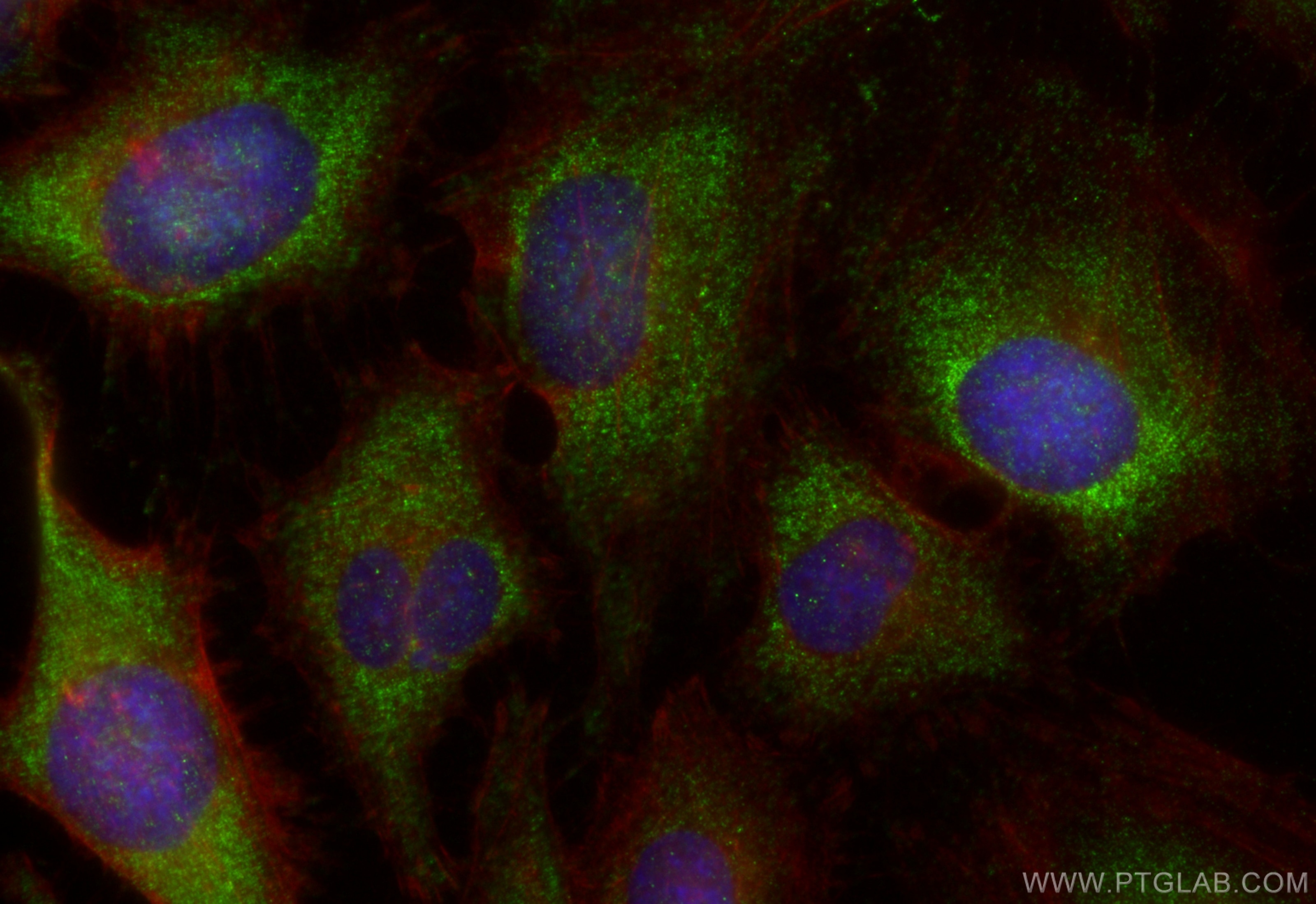 Immunofluorescence (IF) / fluorescent staining of HeLa cells using FMR1 Polyclonal antibody (13755-1-AP)