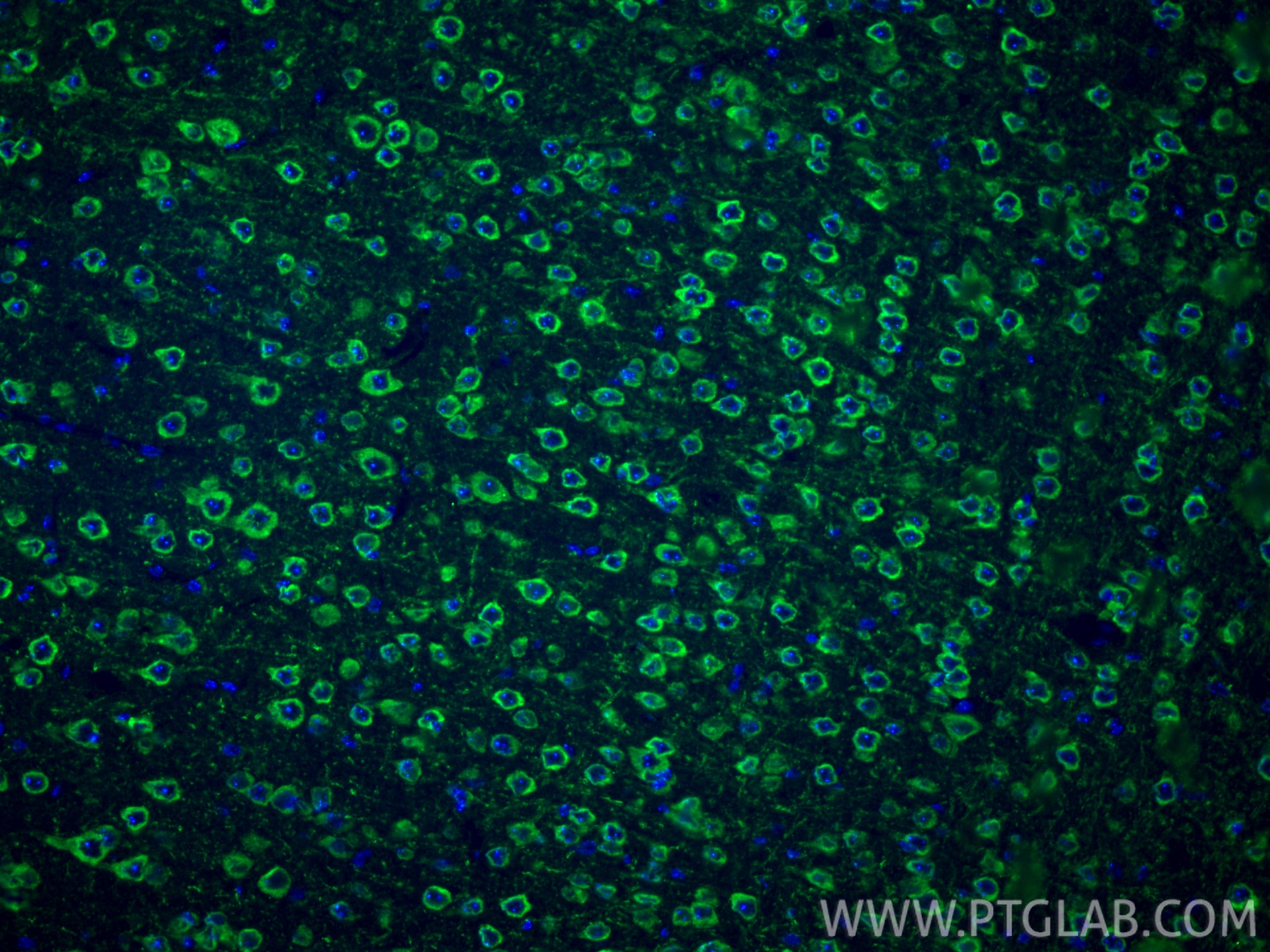 Immunofluorescence (IF) / fluorescent staining of mouse brain tissue using FMRP Polyclonal antibody (13755-1-AP)