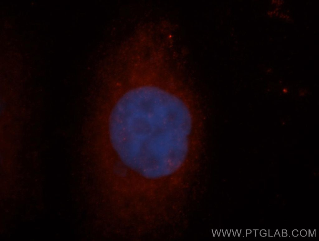 IF Staining of HeLa using 13755-1-AP