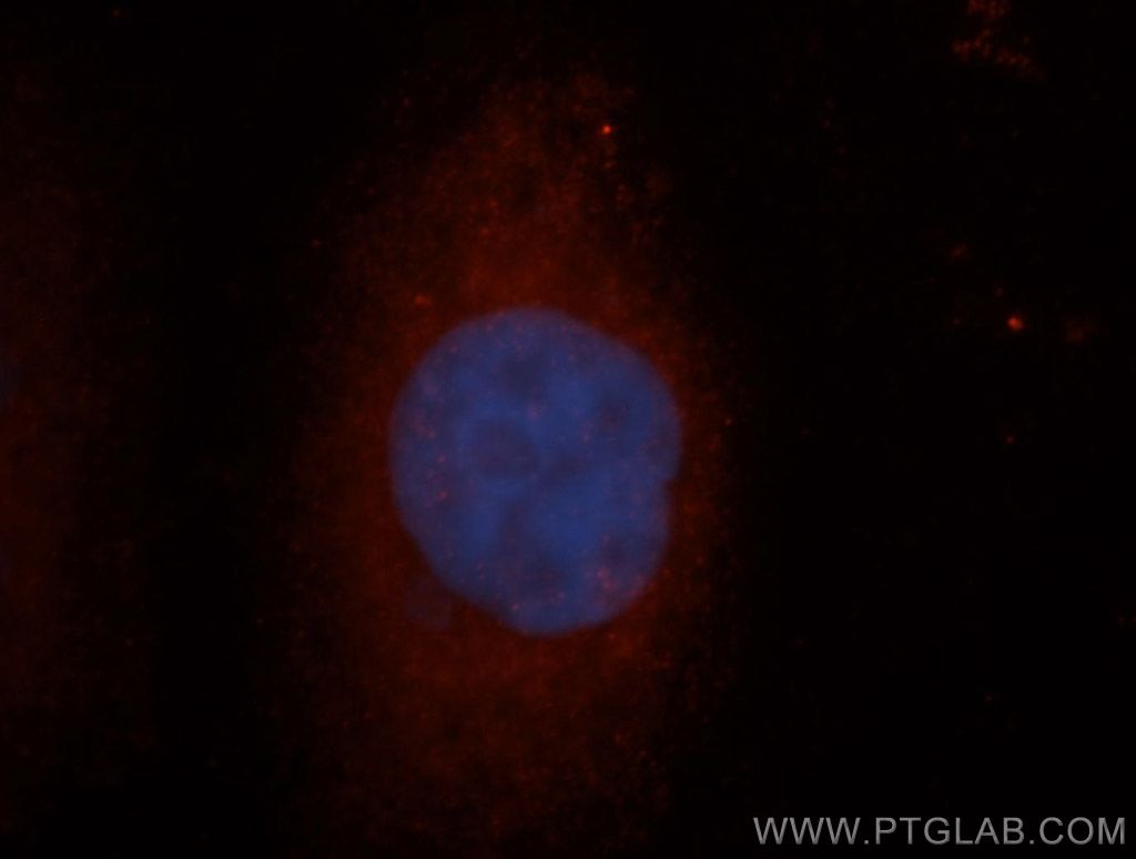 Immunofluorescence (IF) / fluorescent staining of HeLa cells using FMR1 Polyclonal antibody (13755-1-AP)