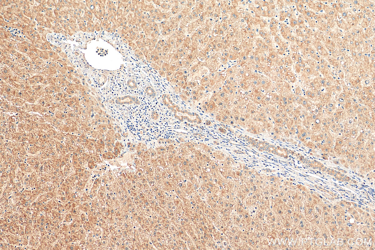 Immunohistochemistry (IHC) staining of human liver tissue using FMR1 Polyclonal antibody (13755-1-AP)