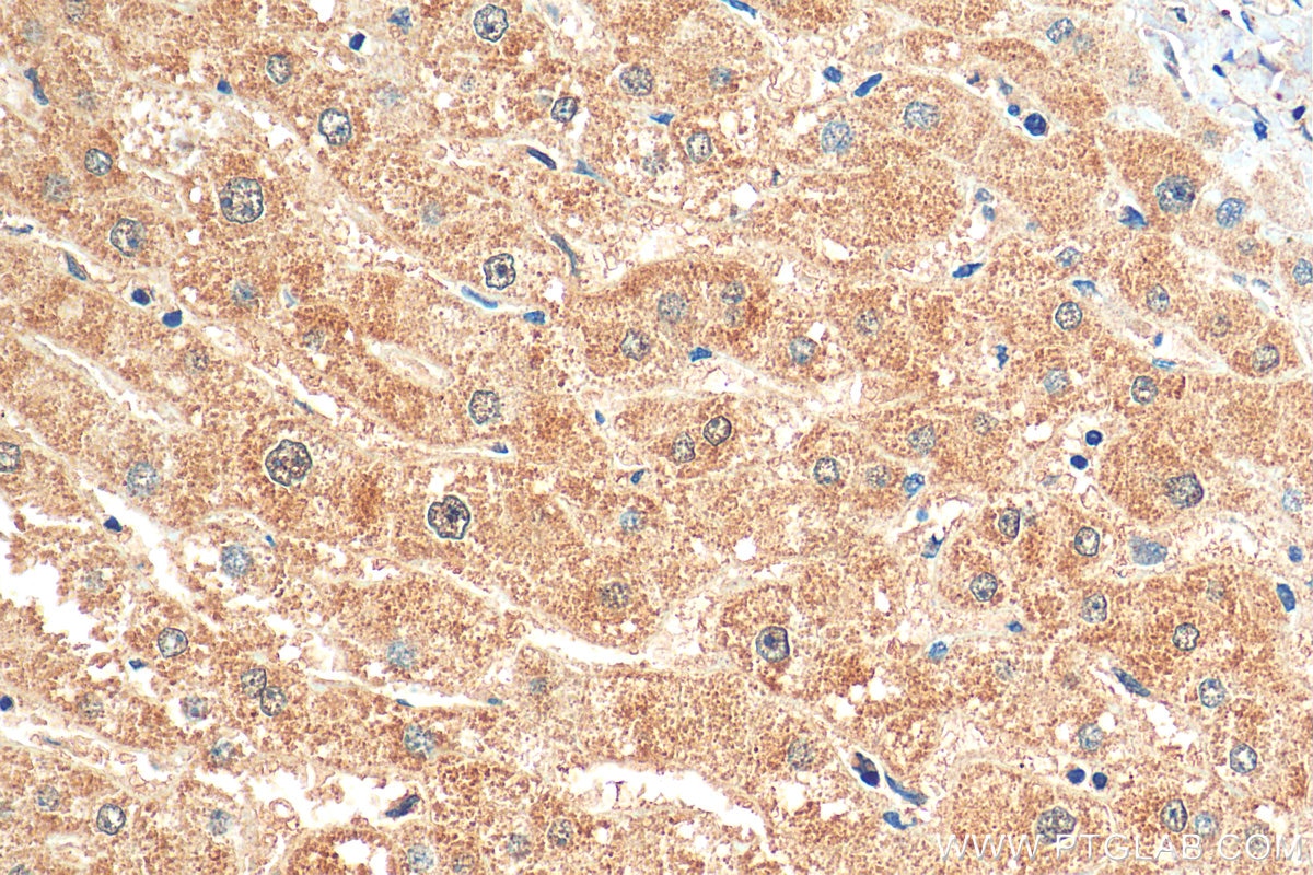 Immunohistochemistry (IHC) staining of human liver tissue using FMR1 Polyclonal antibody (13755-1-AP)