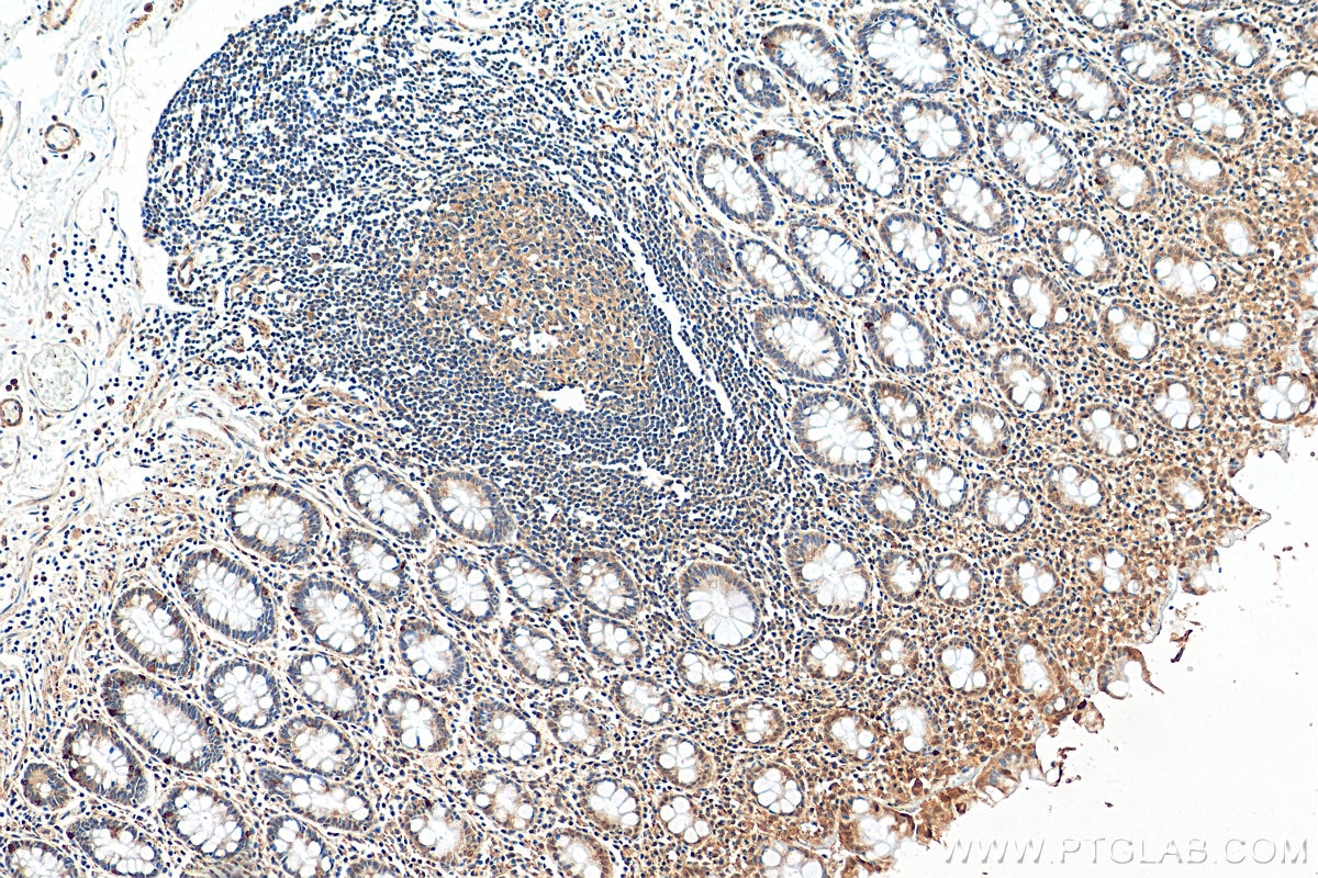 Immunohistochemistry (IHC) staining of human colon tissue using FMR1 Polyclonal antibody (13755-1-AP)