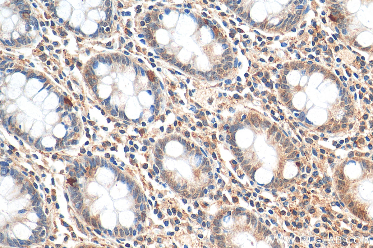 Immunohistochemistry (IHC) staining of human colon tissue using FMR1 Polyclonal antibody (13755-1-AP)
